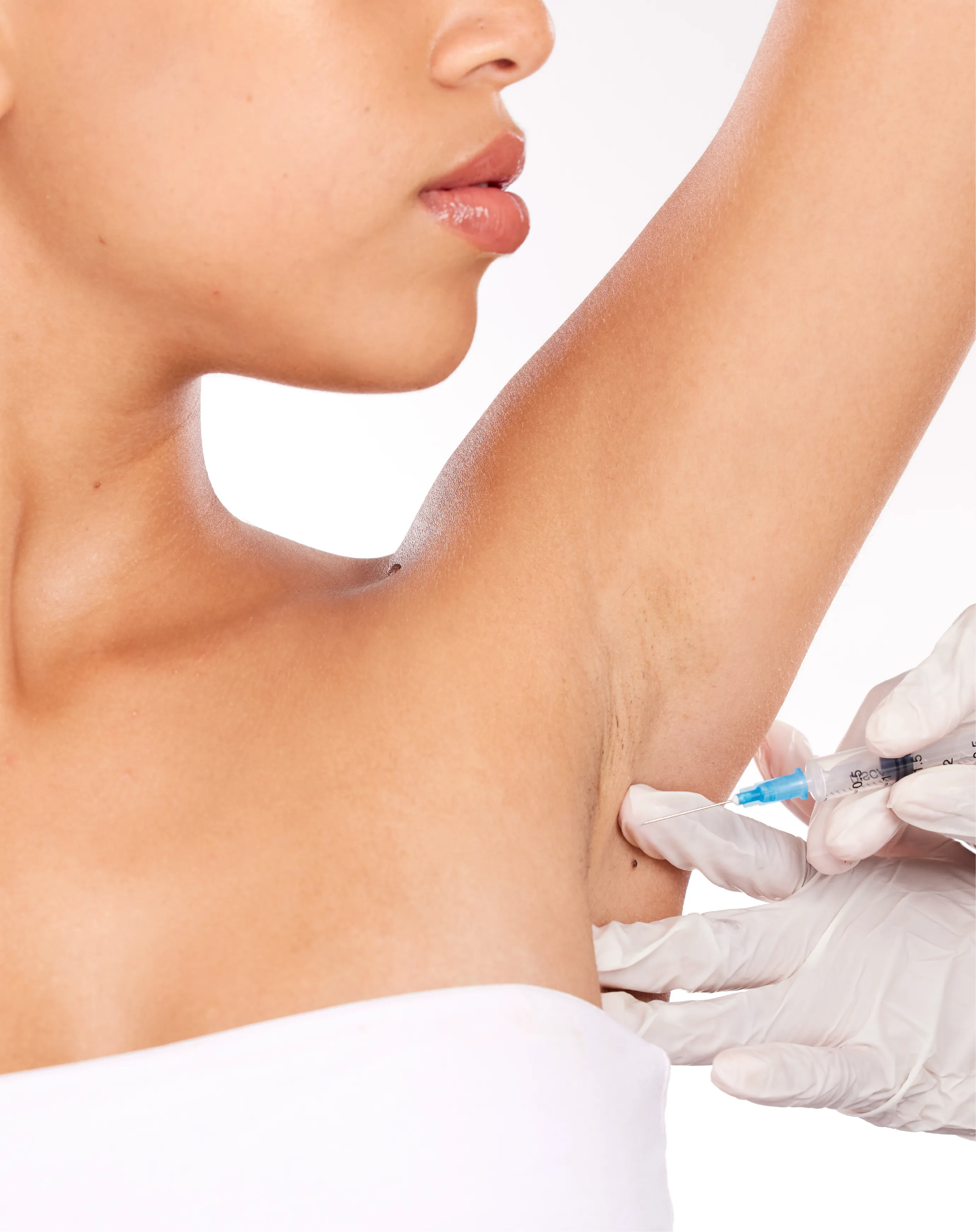 What to expect from Hyperhidrosis Treatment (Underarms & Palms) treatment at Toronto medical spa - treatment journey
